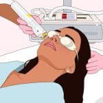 عوارض لیزر موهای زائد